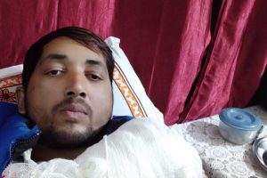 नेपालकै अग्ला राजन अधिकारीको हात भाचियो