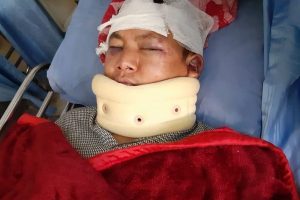 धादिङमा खुकुरी प्रहारबा बाट एकको मृत्यु, एक गम्भिर घाईते