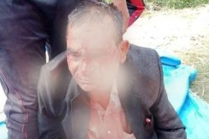 लकडाउनमै कुटिन थाले जनप्रतिनिधि
